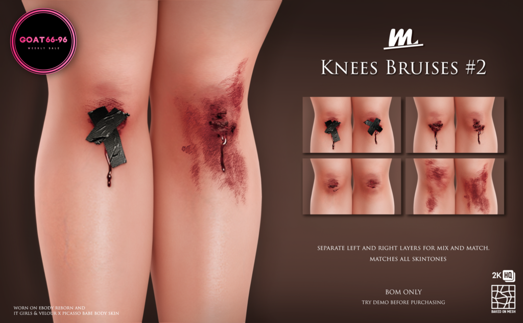 Kness Bruises #2 - BOM